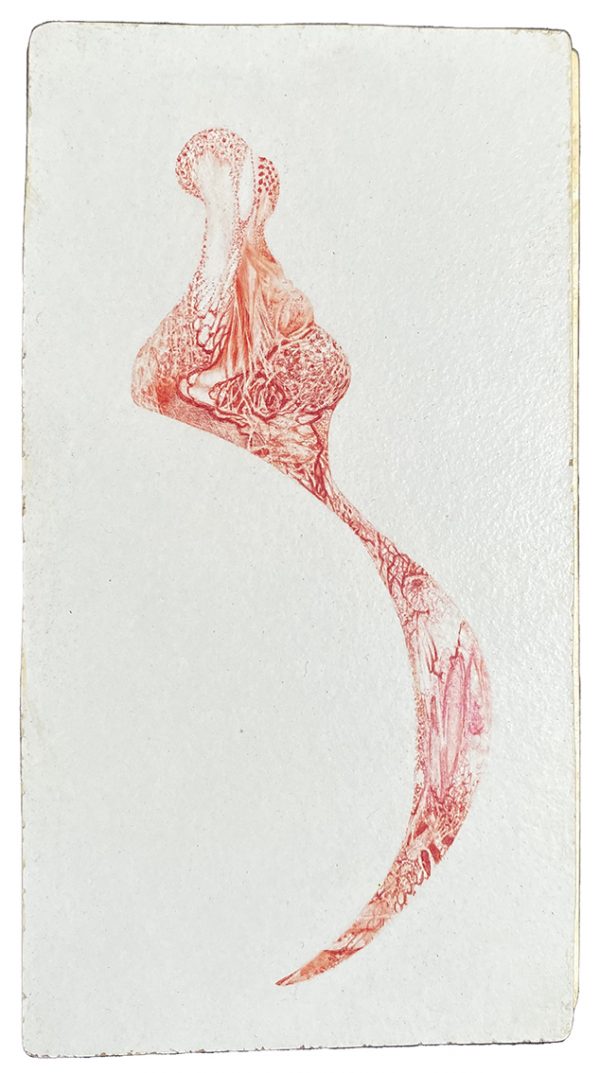 Wound 5